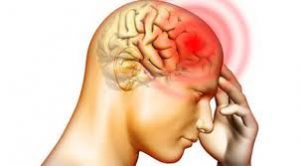 Headache Picture