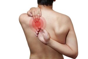 posterior rib subluxation